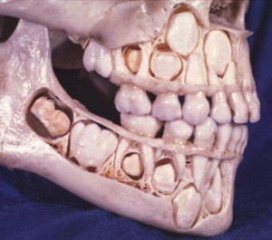 зуб.jpg