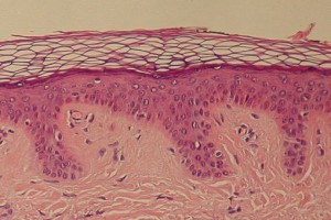 Skin-cross-section_full_size_landscape.jpg